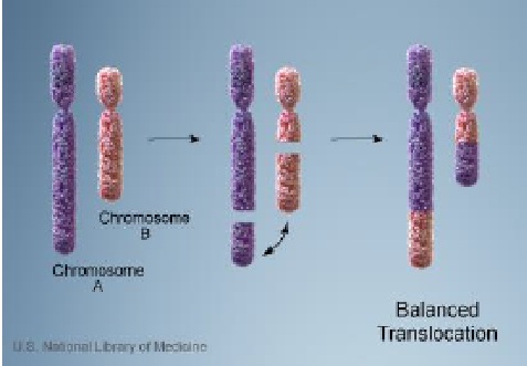 認識染色體平衡轉位